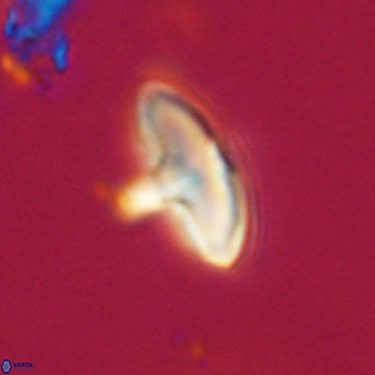 Discoaster aecus VR 30488