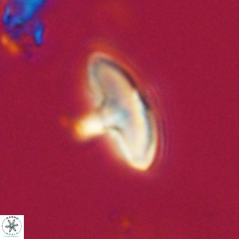 Discoaster aecus VR 30488