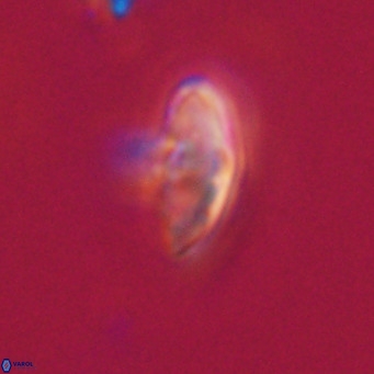 Discoaster aecus VR 30494