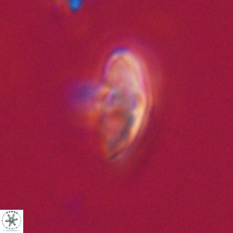 Discoaster aecus VR 30494