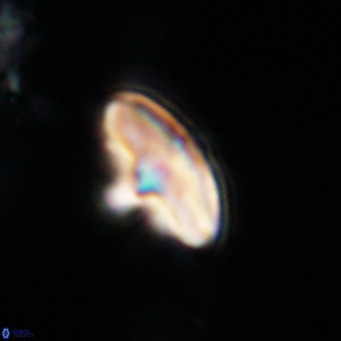 Discoaster aecus VR 30496