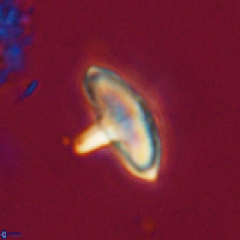 Discoaster aecus VR 30498