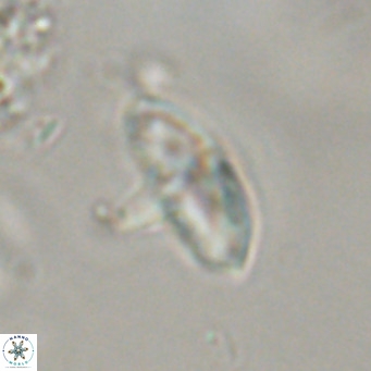 Discoaster aecus VR 30499