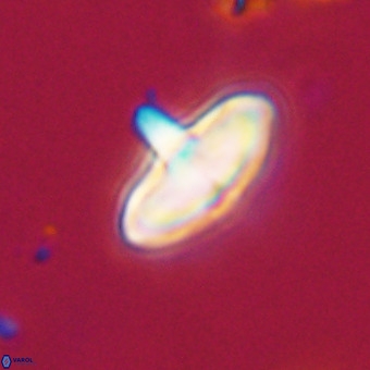 Discoaster aecus VR 30491