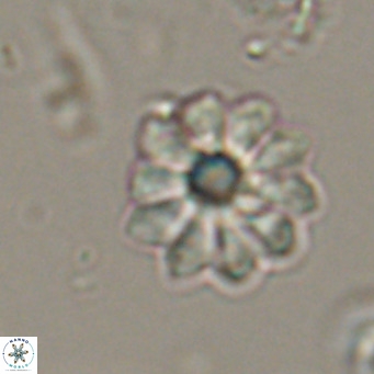 Discoaster aecus VR 30504