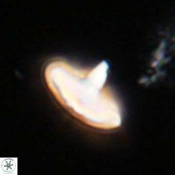 Discoaster aecus VR 30514