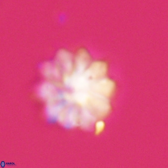 Discoaster aecus VR 30523