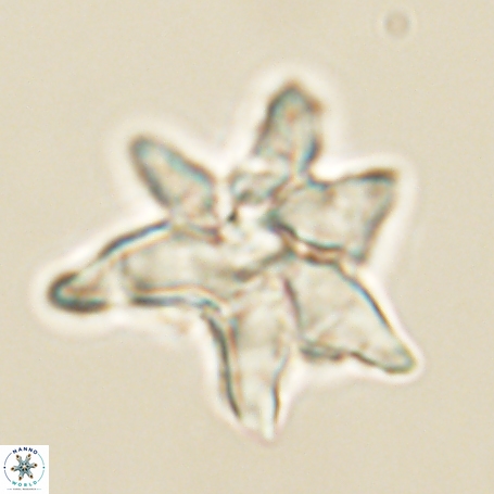 Discoaster aegyptiacus 67910