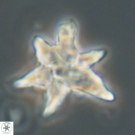 Discoaster aegyptiacus 67926
