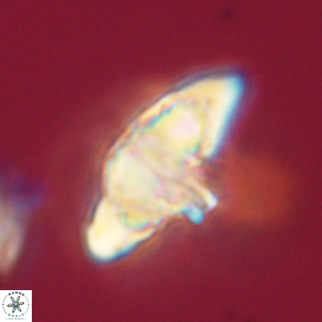 Discoaster aegyptiacus 67920