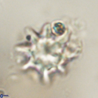 Discoaster akinolgunii 57377