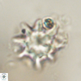 Discoaster akinolgunii 57377
