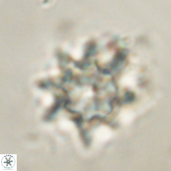 Discoaster akinolgunii 57378