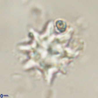Discoaster akinolgunii 57379