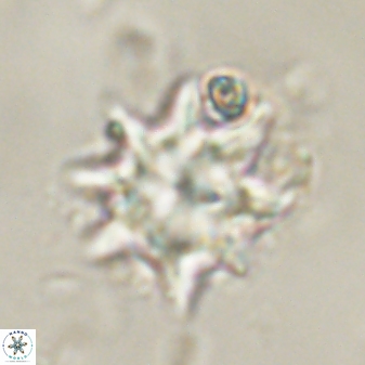 Discoaster akinolgunii 57379