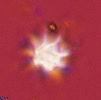 Discoaster akinolgunii 57384