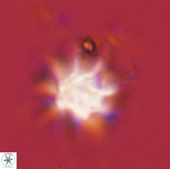 Discoaster akinolgunii 57384