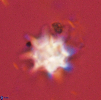 Discoaster akinolgunii 57385