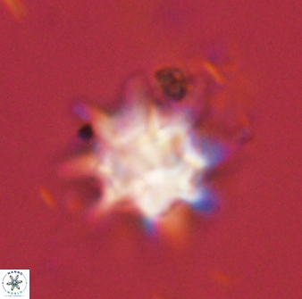 Discoaster akinolgunii 57409