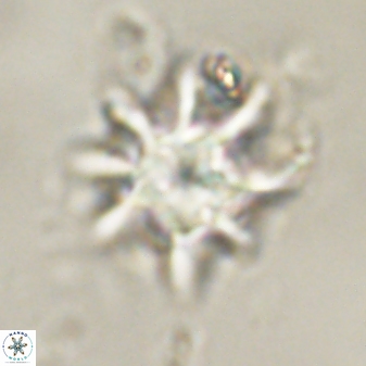 Discoaster akinolgunii 57380