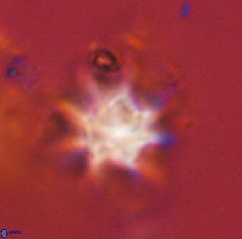 Discoaster akinolgunii 57396