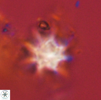 Discoaster akinolgunii 57396