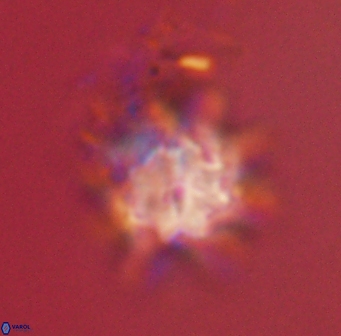 Discoaster akinolgunii 57405