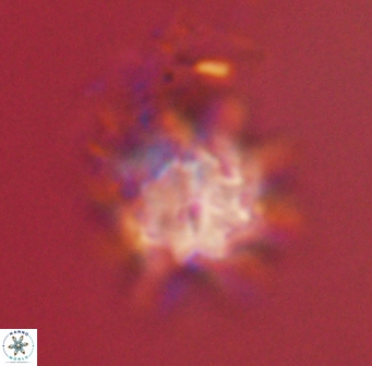 Discoaster akinolgunii 57405