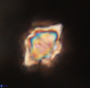 Discoaster akinolgunii 57407