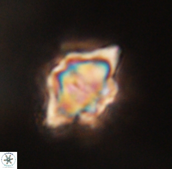 Discoaster akinolgunii 57407