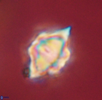 Discoaster akinolgunii 57409