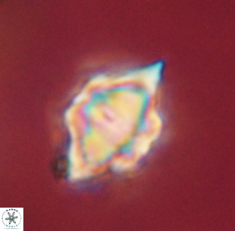 Discoaster akinolgunii 57409