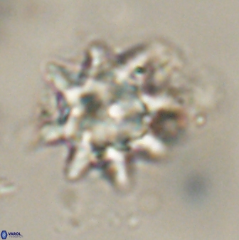 Discoaster akinolgunii 57414