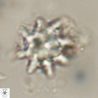 Discoaster akinolgunii 57414