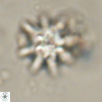 Discoaster akinolgunii 57415