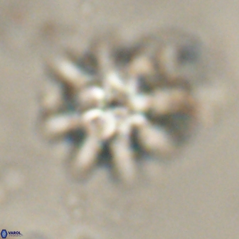 Discoaster akinolgunii 57416