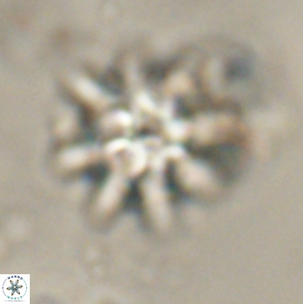 Discoaster akinolgunii 57416