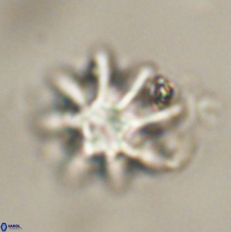 Discoaster akinolgunii 57417