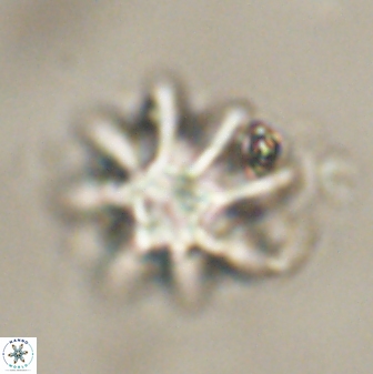 Discoaster akinolgunii 57417