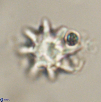 Discoaster akinolgunii 57418