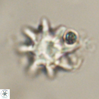 Discoaster akinolgunii 57418