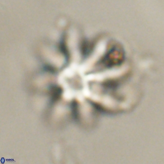 Discoaster akinolgunii 57419