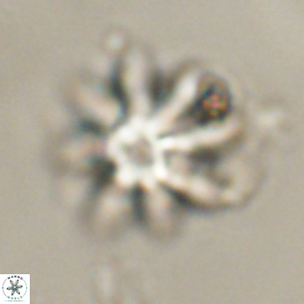 Discoaster akinolgunii 57419