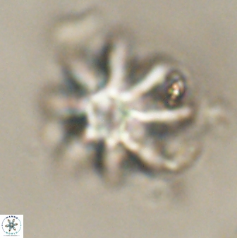 Discoaster akinolgunii 57411