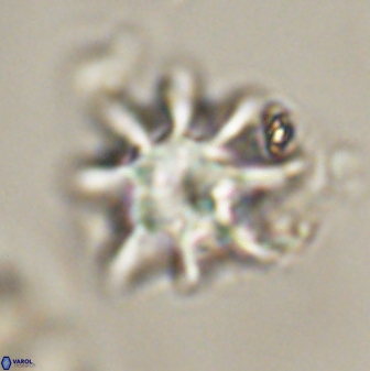 Discoaster akinolgunii 57412
