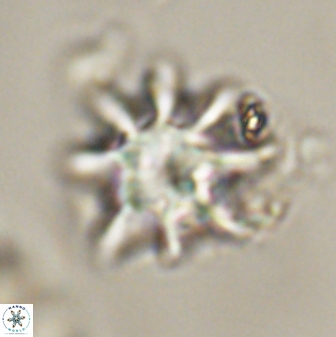 Discoaster akinolgunii 57412