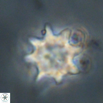 Discoaster akinolgunii 57420