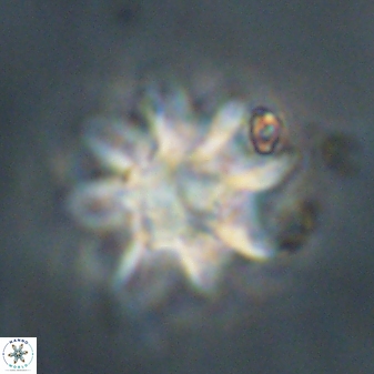Discoaster akinolgunii 57421