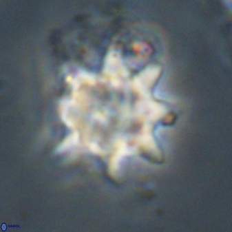 Discoaster akinolgunii 57423