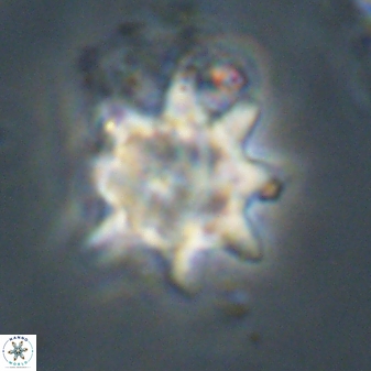 Discoaster akinolgunii 57423